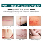 All In 1 Silicone Scar Removal Strips